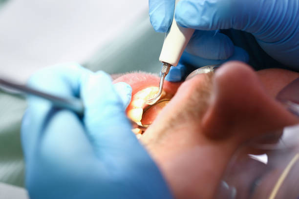 Best Walk-In Emergency Dentist in Shinnston, WV